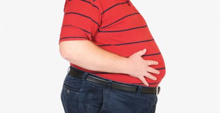 بررسی علل و عوامل خطر چاقی مفرط - وندا